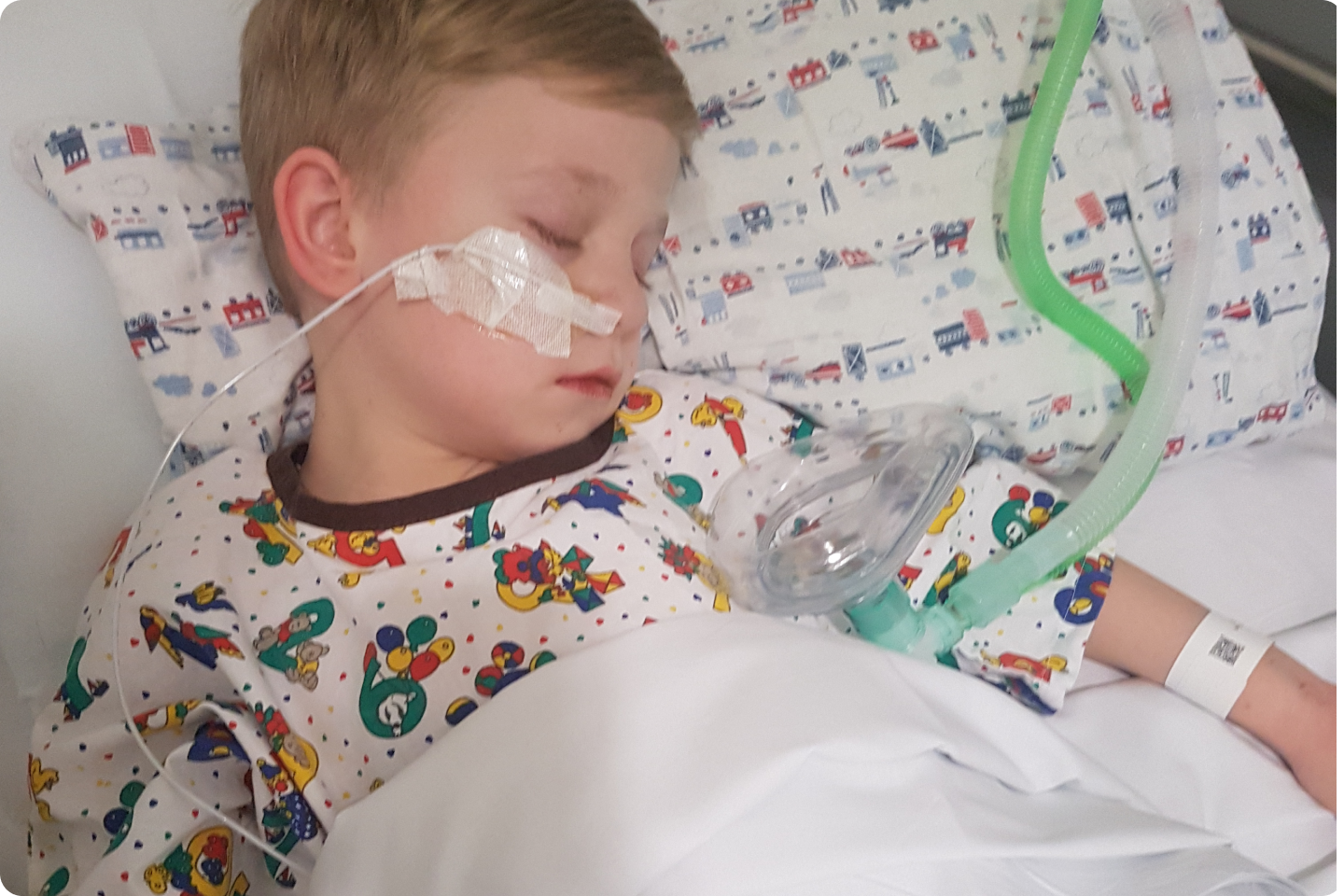 A young child sleeps in a hospital bed, wearing a colorful gown with cartoon characters. An oxygen mask is near their face, and a medical tube is taped to their cheek. The pillow and sheets have a toy transportation pattern.